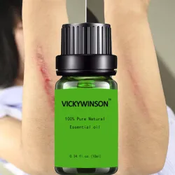 Rimozione della cicatrice e trattamento dell'acne - olio di massaggio della lavanda 10 ml