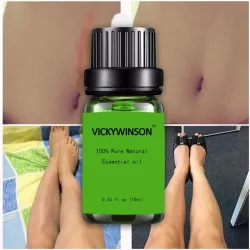 Scar borttagning & akne behandling - lavendel massage olja 10 ml
