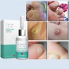 Liquid for removing skin tags - moles - warts - lightening freckles - 10mlSkin