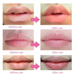 Lip gel mask - anti-rynka - fuktkräm - kollagen fläckar - 5 - 7 - 10 bitar