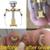 EquiposCorrector de uñas ingrown profesional - elevador - acero inoxidable