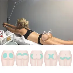 Buttcock / breast enlargement - vacuum machine - massager with 6 suction cups