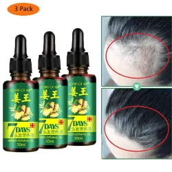 3 peças - líquido de crescimento do cabelo - essência gengibre - tratamento de 7 dias