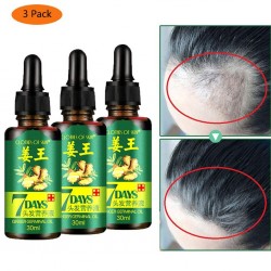 3 Stück - Haarwachstum Flüssigkeit - Ingwer Essenz - 7 Tage Behandlung