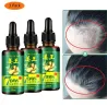 Cabello3 piezas - crecimiento del cabello líquido - esencia del jengibre - 7 días tratamiento