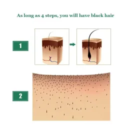 Cabello3 piezas - crecimiento del cabello líquido - esencia del jengibre - 7 días tratamiento
