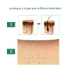 Cabello3 piezas - crecimiento del cabello líquido - esencia del jengibre - 7 días tratamiento