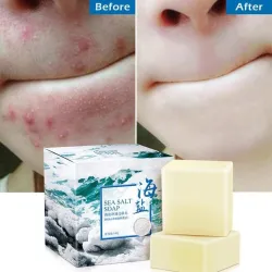 Savon de miel - Lait de chèvre - Supprimer l'acné - Clean Skin - Blackhead Remover