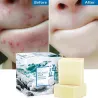 Savon de miel - Lait de chèvre - Supprimer l'acné - Clean Skin - Blackhead Remover