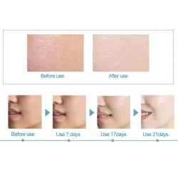 Hyaluronsyraessens - fuktgivande - anti rynka - anti allergi - ansiktslyft serum