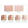 Hyaluronsyraessens - fuktgivande - anti rynka - anti allergi - ansiktslyft serum