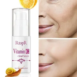 Hyaluronzuur gezichtsserum - vitamine C - anti-aging / krimp poriën / whitening / hydraterendHuid