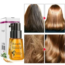 Essential hair oil - prevent hair loss - 35ml