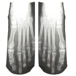 Short socks - foot X-ray print - unisex
