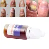 TratamientoMedicina china - reparación de uñas para onicomicosis - hongos en las uñas - 10 ml