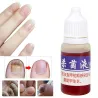 Kinesisk medicin - nagelreparation för onykomykos - nagelsvamp - 10 ml