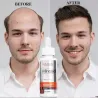 Olio essenziale per la crescita dei capelli - liquido anticaduta - siero