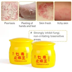 Medicinsk creme - urtesalve - psoriasis / eksem / pruritus / dermatitis / smertelindring