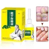15ml - trattamento micotico unghie - rimozione - liquido riparatore unghie
