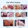 15ml - nagelsvampbehandling - borttagning - nagelreparationsvätska