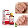 Tånegle svamp fjernelse gel - serum - anti infektion / paronychia / onychomycosis - 10ml