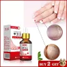 Toenail fungus removal gel - serum - anti infection / paronychia / onychomycosis - 10mlTreatment