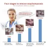 Tånagelsvampborttagningsgel - serum - antiinfektion / paronychia / onychomycosis - 10ml