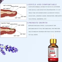 Żel do usuwania grzybicy paznokci - serum - przeciw infekcjom / zanokcikom / grzybicy paznokci - 10mlLeczenie