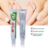 Atlets fodcreme - anti-kløe - anti-sved - anti-lugt - fodpsoriasis - smertelindring - antibakteriel salve