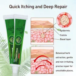 Crème contre le psoriasis - dermatite - eczéma - anti-démangeaisons - pommade antibactérienne à base de plantes