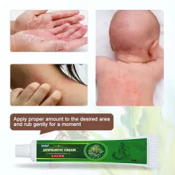 Krem na łuszczycę - zapalenie skóry - wypryski - przeciwświądowy - ziołowa maść przeciwbakteryjnaSkóra