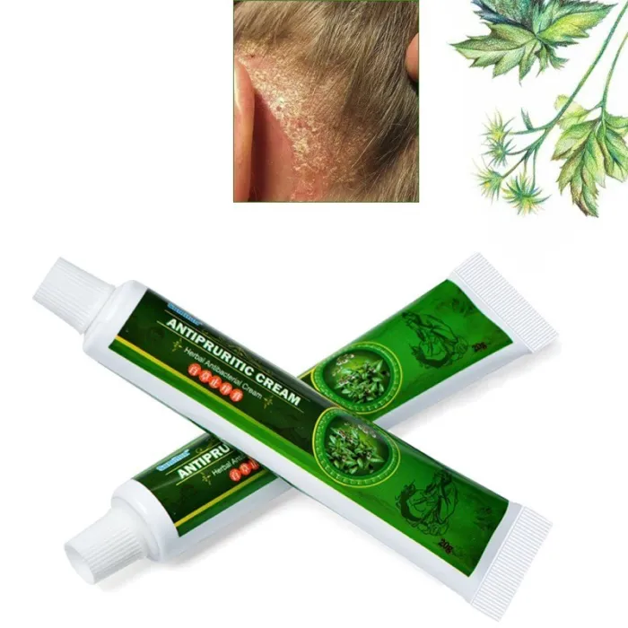 Crème contre le psoriasis - dermatite - eczéma - anti-démangeaisons - pommade antibactérienne à base de plantes