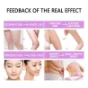 Slimming spray - fat burner - anti-cellulite - firming - 30mlMassage