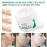 Crème anti-cicatrices - vergetures - marques d'acné - soin visage/corps - 50 ml