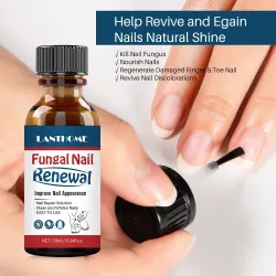 TratamientoAceite antifúngico para uñas - sérum líquido reparador