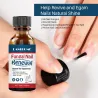 Negler soppdrepende olje - reparer flytende serum