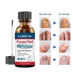 Negler soppdrepende olje - reparer flytende serum