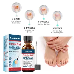 Negler soppdrepende olje - reparer flytende serum