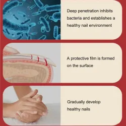TratamientoAceite de eliminación de onicomicosis - suero líquido de esencia
