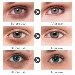 Aufhellendes Augenserum - Vitamin C