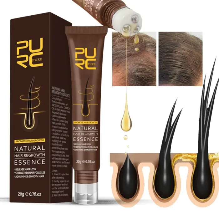 Hair growth essence - ginger oil - anti hair lossHair