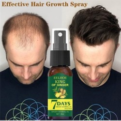 Essence de croissance des cheveux - spray anti-chute de cheveux