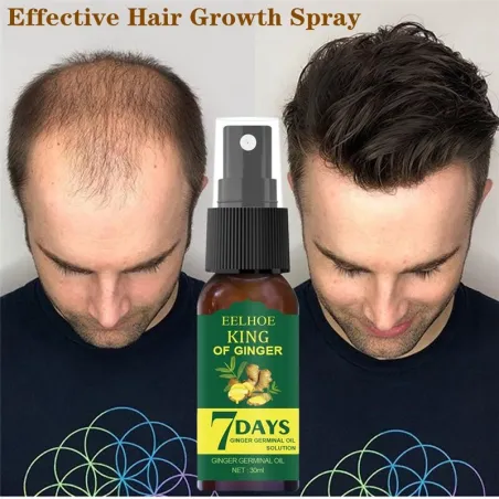 Haargroeiessentie - spray tegen haaruitvalHaar