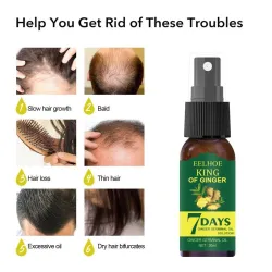 Ginger care hair growth essence spray – nourish roots, repair damage & revitalize scalp for stronger, healthier hairHair