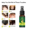 Ginger care hair growth essence spray – nourish roots, repair damage & revitalize scalp for stronger, healthier hairHair
