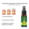Ginger care hair growth essence spray – nourish roots, repair damage & revitalize scalp for stronger, healthier hairHair