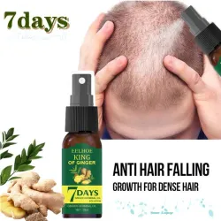 Ginger care hair growth essence spray – nourish roots, repair damage & revitalize scalp for stronger, healthier hairHair