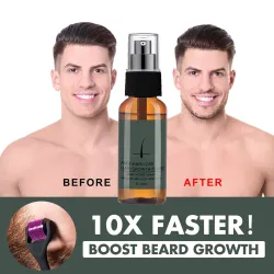 Skæg / hårvækst essens - spray - med nålerulle massager - mod hårtab