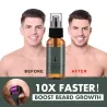 Beard / hair growth essence - spray - with needle roller massager - anti hair lossBeard