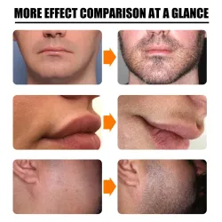 Beard / hair growth essence - spray - with needle roller massager - anti hair lossBeard